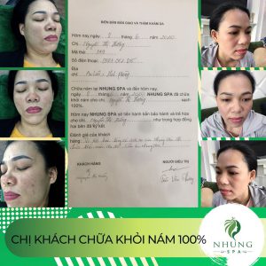 DẤU ẤN TUỔI 40 – TRẺ ĐẸP TỰ TIN VỚI CHÍNH MÌNH MỜI CHỊ EM TÌM HIỂU THÊM TẠI NHUNG SPA