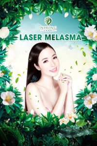 Laser Melasma – Tiêu chuẩn vàng trong điều trị nám