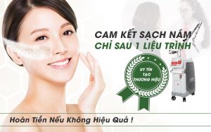 Để nám không còn là nỗi ám ảnh với phái đẹp