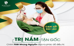 Laser Melasma, Mầm Sinh trị nám tận gốc.