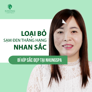 Plus Melasma thổi bay thâm nám, quét sạch chàm đen