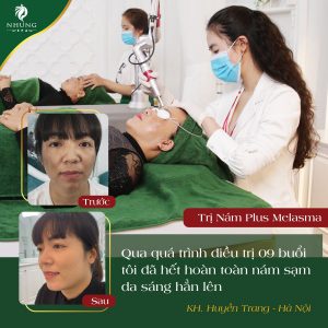 Bí Quyết Sau 01 Buổi Mờ Nám Tại Nhung Spa – Đăng Ký Nhận Để Trải Nghiệm Miễn Phí Ngay Nào.