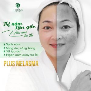 Nám Sạch Từng Buổi – Không Lo Tái Phát Với Plus Melasma 2021 Tại Nhung Spa