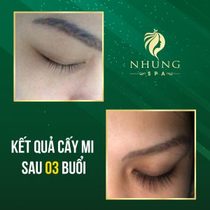 Cấy Mi Sinh Học Nano Là Gì? Giữ Được Bao Lâu ? Giá Dịch Vụ Cấy Mi Bao Nhiêu Tiền?