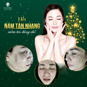 Tại Sao Trị Nám Tại Nhung Spa Lại Hiệu Quả Như Vậy – Hãy Khám Phá Phác Đồ Trị Nám Và Công Nghệ Plus Melasma Tại Nhung Spa Ngay Nào.