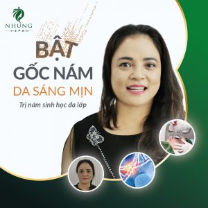 Cần Làm Gì Khi Bị Nám Da Mặt Để Ngăn Ngừa Bệnh Tái Phát Sau Điều Trị