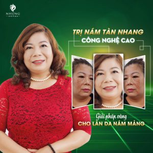 Trị Nám Laser Plus Melasma Công Nghệ Cao Là Như Thế Nào ?