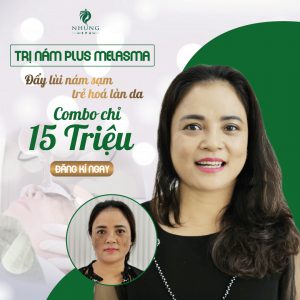 Tin Vui Cho Những Chị Em Đang Bị Nám – Trọn Gói Điều Trị Nám Với 15Tr Bằng Công Nghệ Plus Melasma