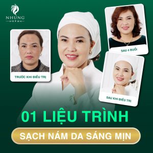 TỰ TIN CAM KẾT BẰNG VĂN BẢN CHỮA KHỎI CHÀM ĐEN, NÁM CỰC NẶNG CHỈ CÓ THỂ LÀ NHUNG SPA