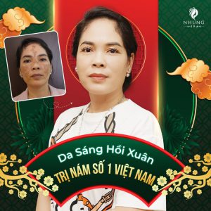 Da Nám Hồi Xuân – Trị Nám Số 1 Việt Nam