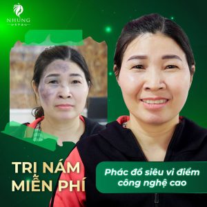 Trị Nám Chàm Đen Miễn Phí – Phác Đồ Siêu Vi Điểm Cao Cấp Tại Nhung Spa