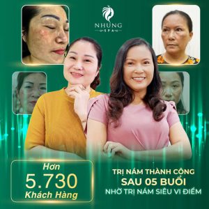 Chị Em Đừng Chủ Quan Trước Những Nguyên Nhân Gây Nám Da Sau Sinh